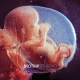 Cover: MoTrip - Embryo