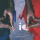 Cover: Kendrick Lamar - I