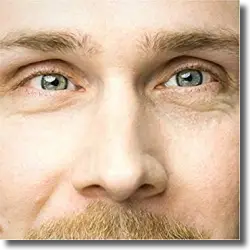 Cover: Kowsky - Blinder Fleck